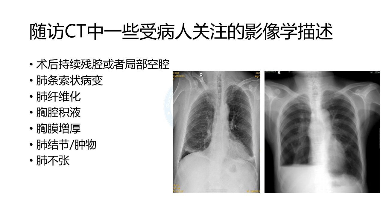 幻灯片14.PNG