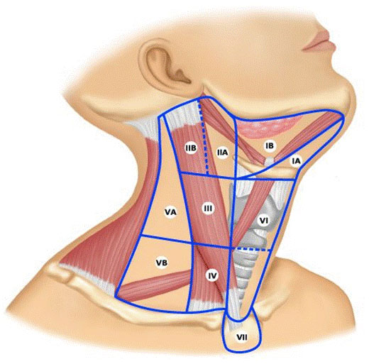 颈部淋巴结分区JPG2.jpg