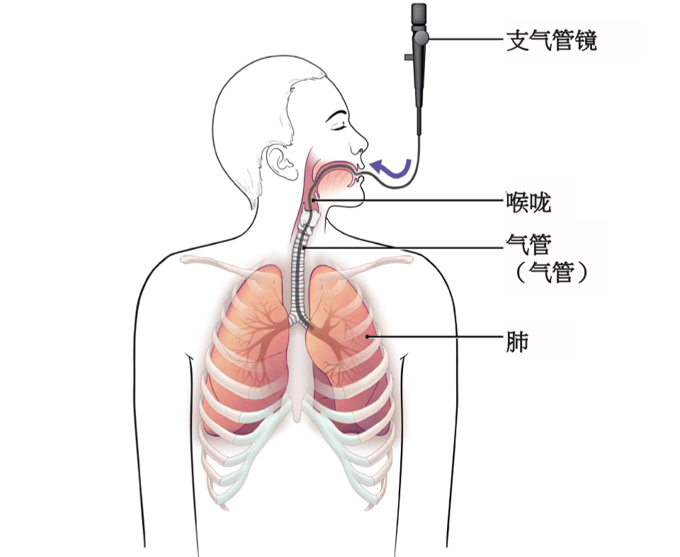 060609支气管镜检查后须知.jpg