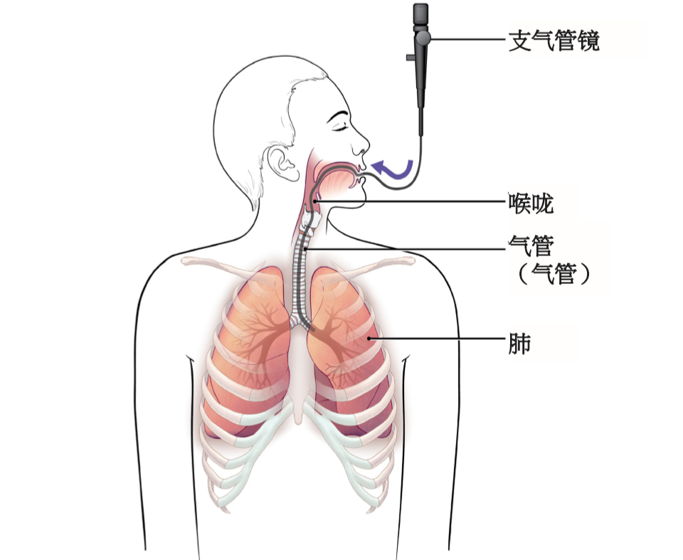 纤维支气管镜解剖图谱图片