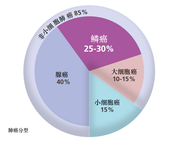 肺癌种类图片