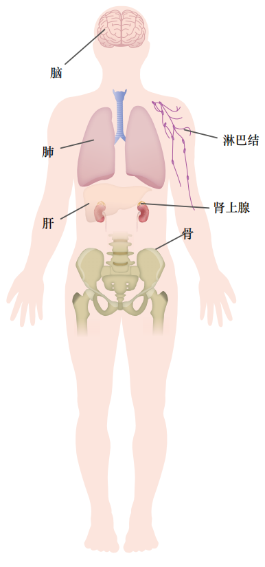 鳞癌的可能转移部位.PNG