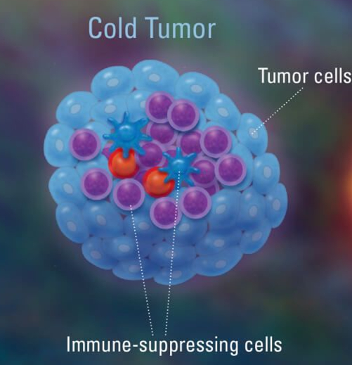 什么是冷肿瘤？