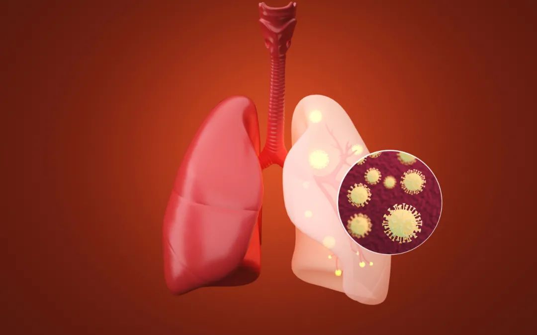 肺癌有什么类型？